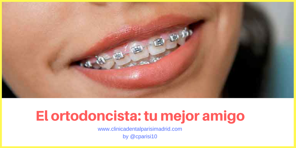 el ortodoncista tu mejor amigo